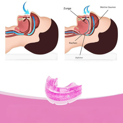 🔥✨ Anti-Schnarch- & Anti-Zähneknirschen-Schutz 🎉 Zweite zum halben Preis